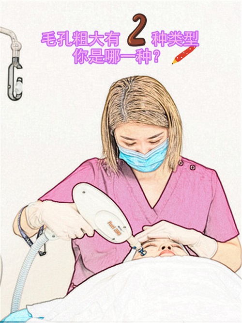 天津南开医院医学美容医院鼻孔处的痣可以选择激光去痣去除吗