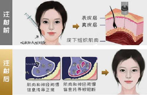 绵阳市涪城区韩美医疗美容诊所瘦脸*补*两次需间隔多久？