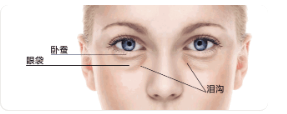 割双眼皮有哪些种类？什么是开扇形、什么是平行形,什么是欧式呢