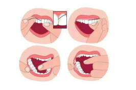 深圳龙普兰特口腔一颗种植牙要多少钱?龙普兰特牙齿矫正案例详情