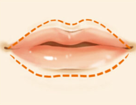 玻尿酸丰唇的恢复时间要多久？想要恢复快，术后一定要注意这些！
