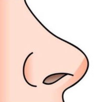 胶原蛋白鼻整形术的后遗症是什么？鼻综合整形真实案例！