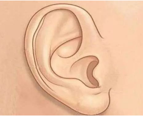 耳廓再造手术需要多久？耳廓再造的注意事项全新曝光。