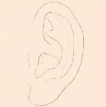 外耳廓整形使用什么方法？耳部矫正修复后的注意事项有哪些？