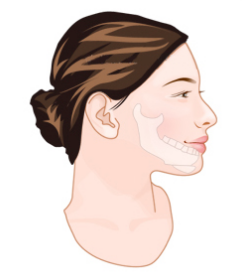 磨骨改脸型有后遗症吗?磨骨手术价格会受到哪些因素影响？