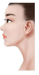 鼻子缩小手术的后遗症有哪些？鼻头能缩小吗？原理!注意事项。